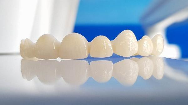 فراوری قطعه ای کاربردی در دندان برای اولین بار در خاورمیانه
