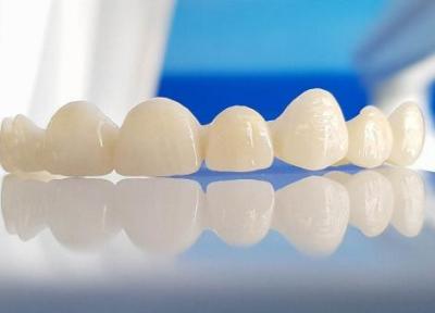 فراوری قطعه ای کاربردی در دندان برای اولین بار در خاورمیانه